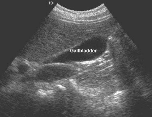 Services | UltraSound